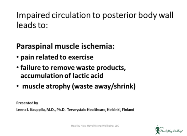 Preview: Impaired circulation to posterior body wall leads to paraspinal muscle ischemia.